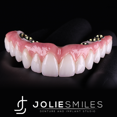 Hybrid Implant Bridge